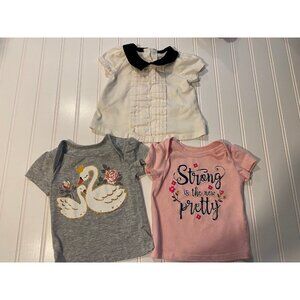 Baby girl top bundle